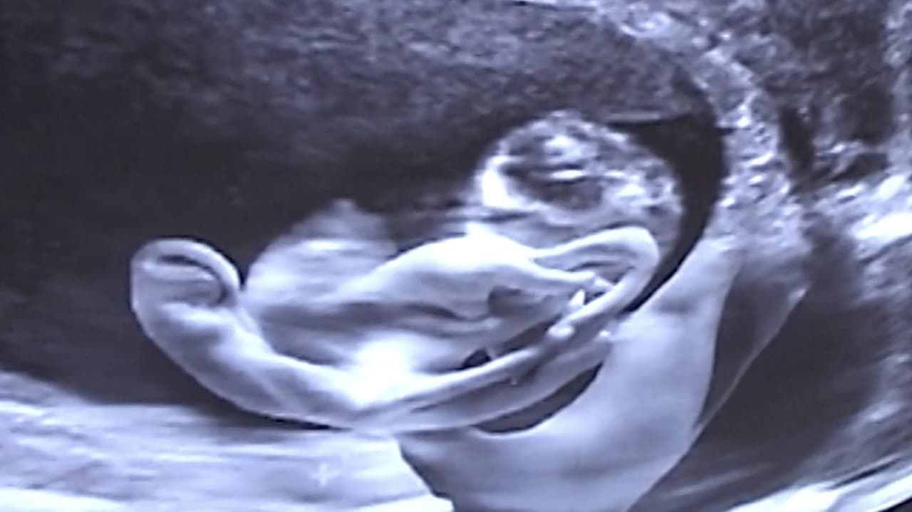 Backdrop – Castration Movie Anthology iii. Year of the Hyaena