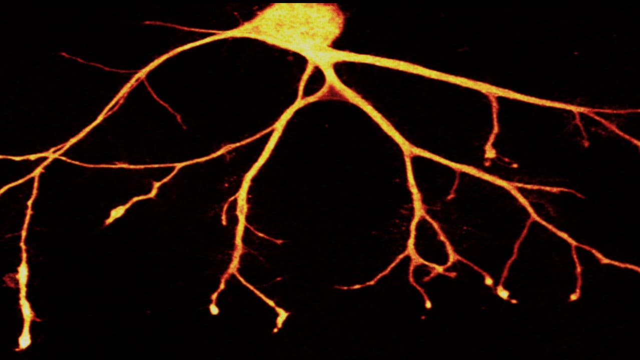 Backdrop – Auf der Suche nach dem Gedächtnis
