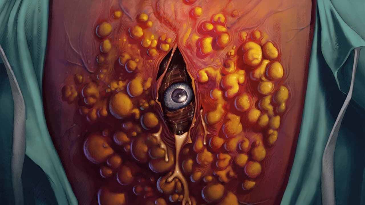 Backdrop – Cyst