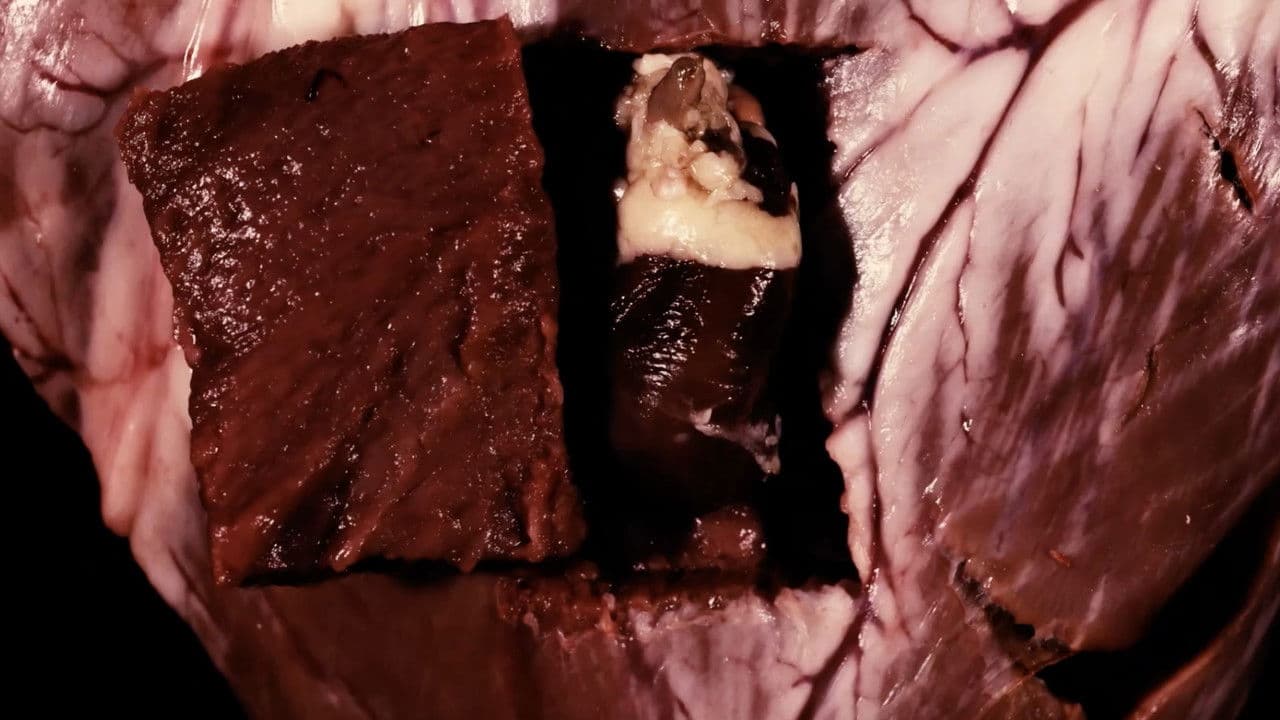 Backdrop – Visceral