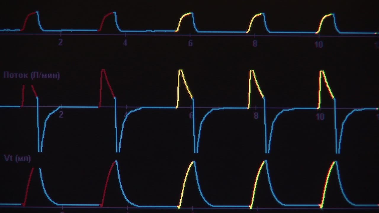 Backdrop – Линар