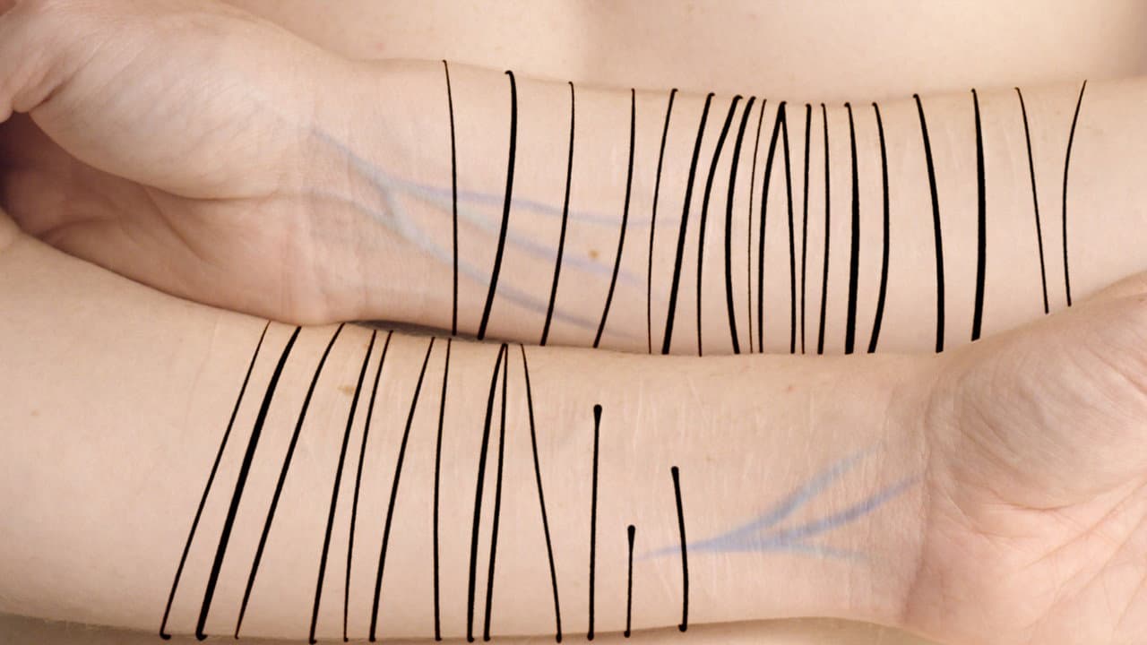 Backdrop – Scars
