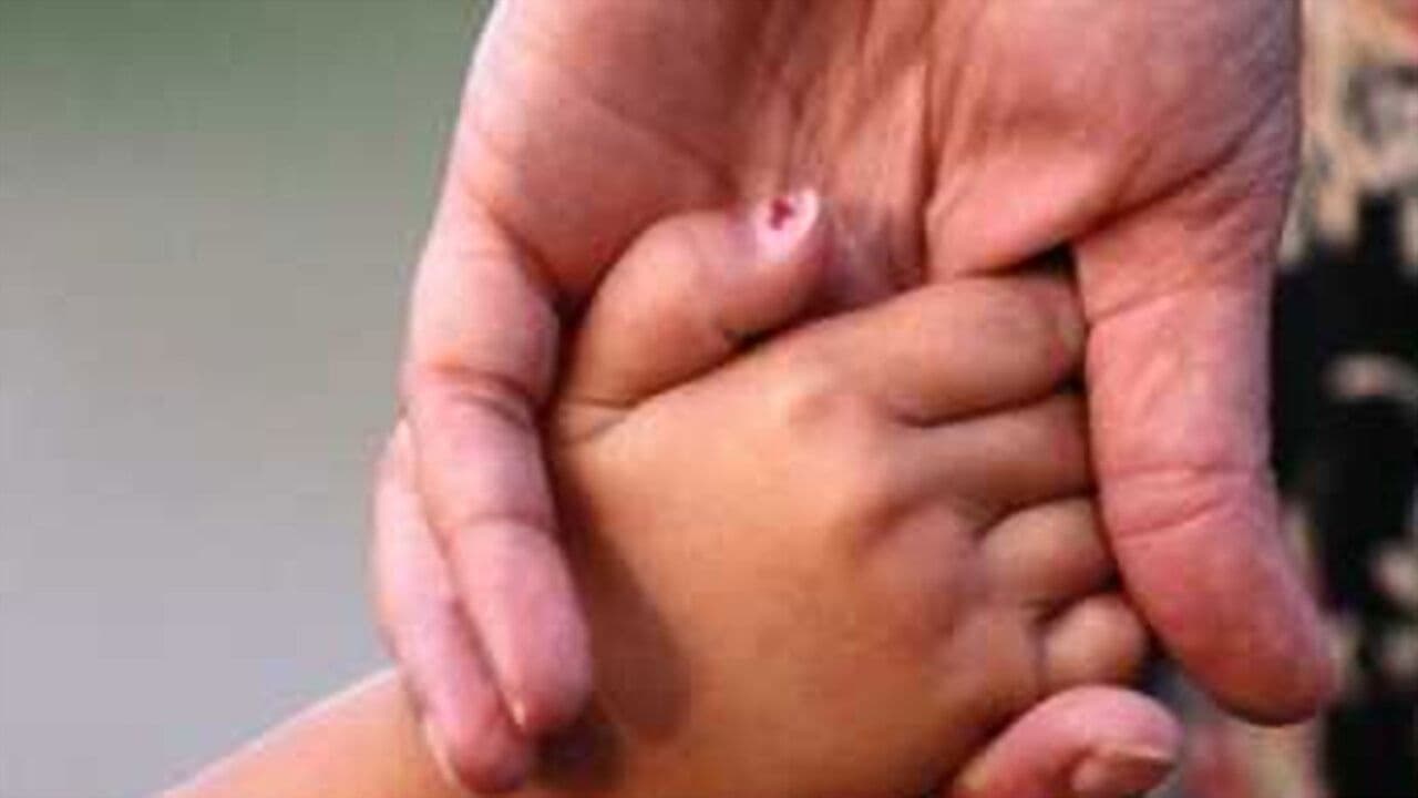 Backdrop – I Have Tourette's But Tourette's Doesn't Have Me