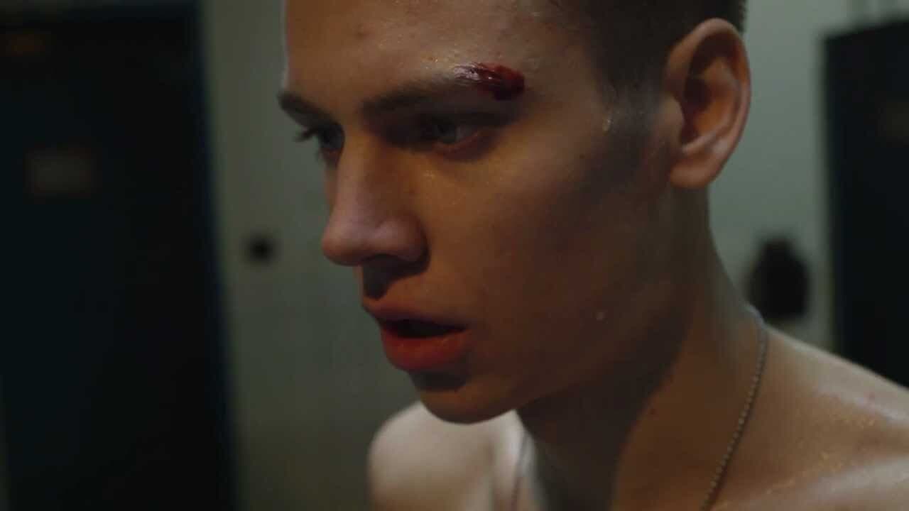 Backdrop – Homophobia