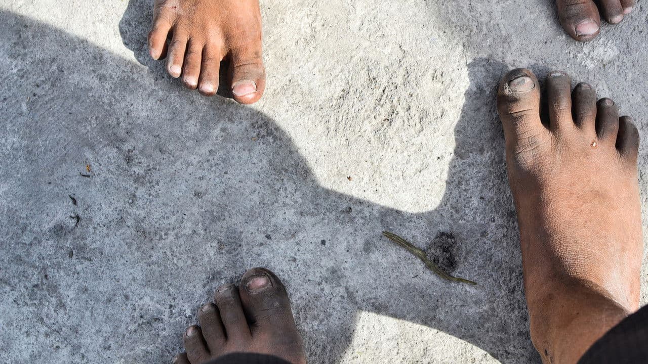 Backdrop – Mi no lugar