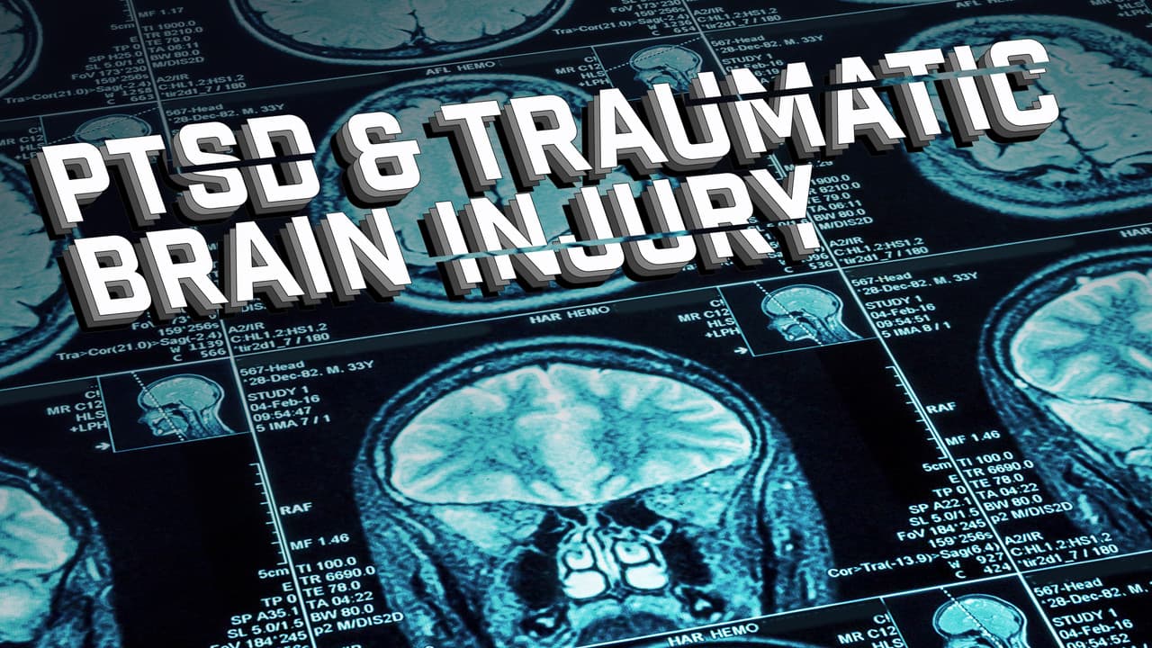 Backdrop – Joel Hunt: Traumatic Brain Injury (TBI)