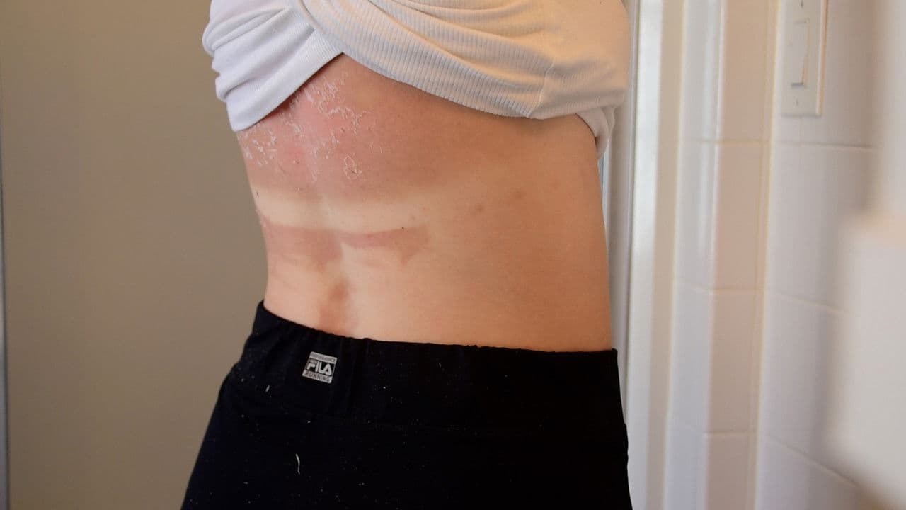 Backdrop – Like a Fire that Consumes All of It