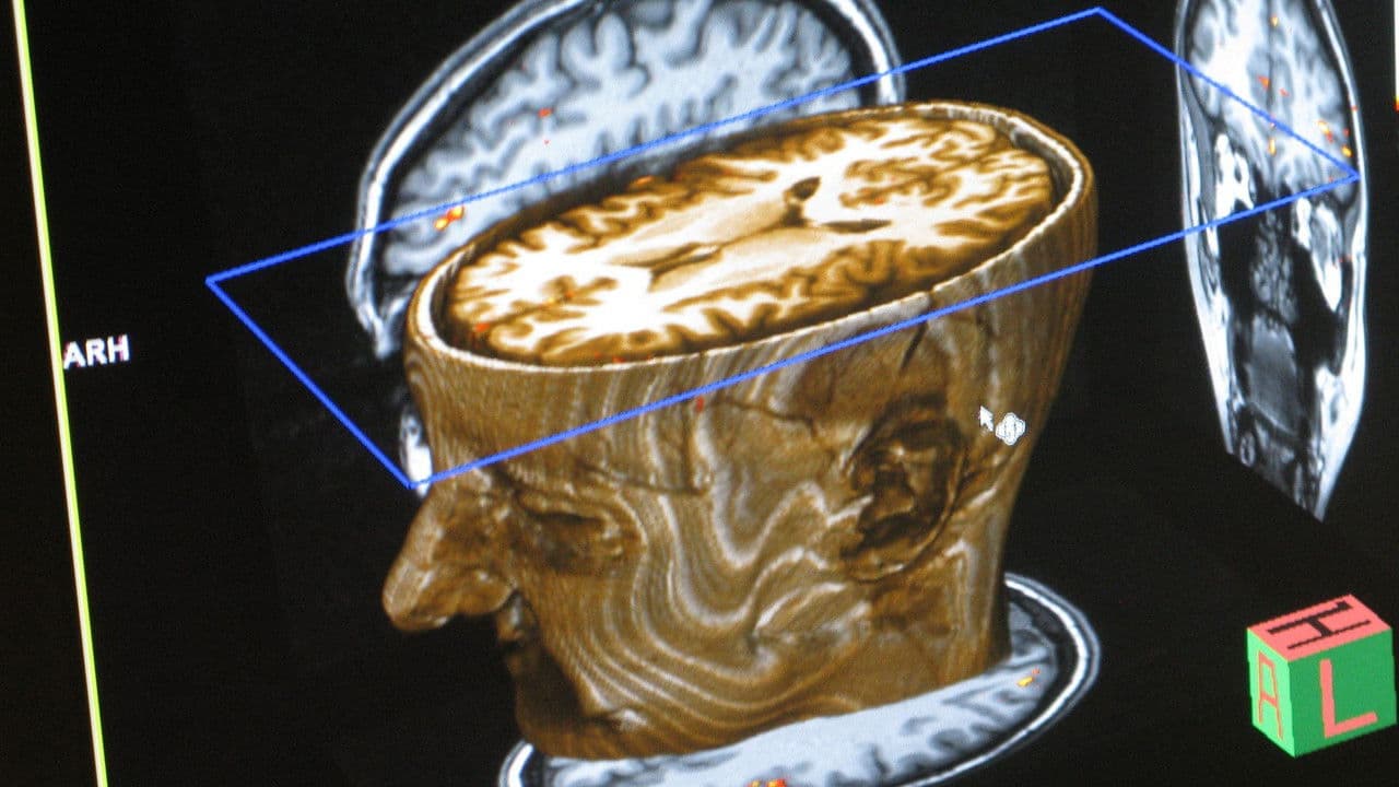 Backdrop – Journey Into Dyslexia