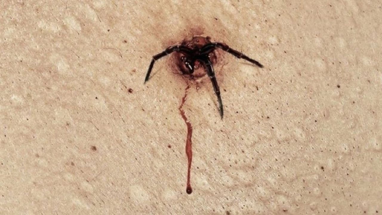 Backdrop – The Plague