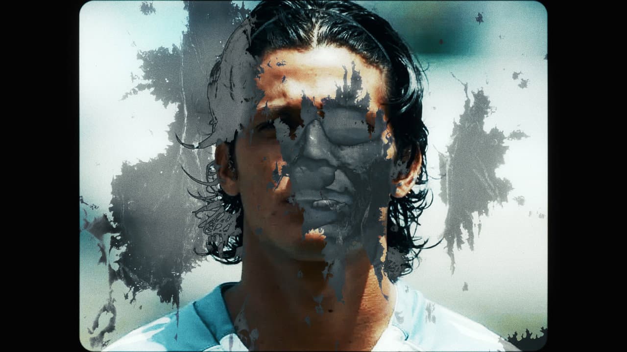 Backdrop – Vitiligo