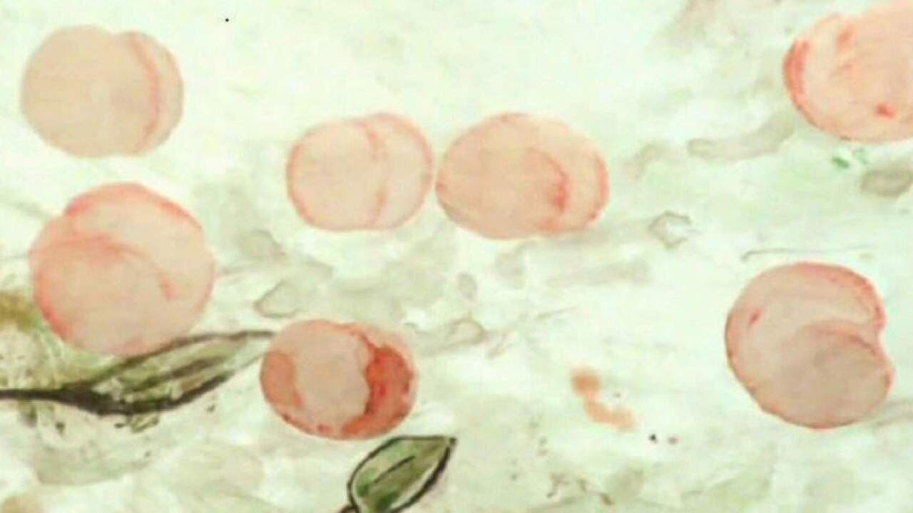 Backdrop – Жук, корабль, абрикос