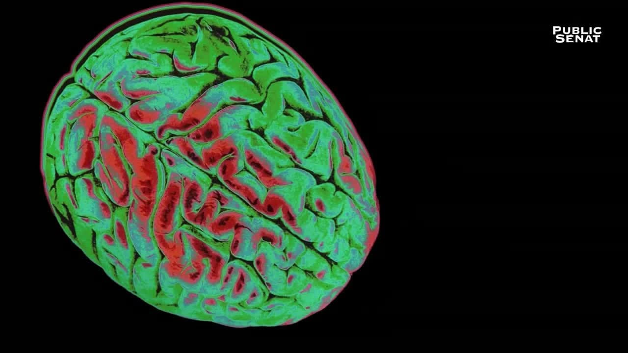 Backdrop – Le pouvoir nuit-il gravement au cerveau ?