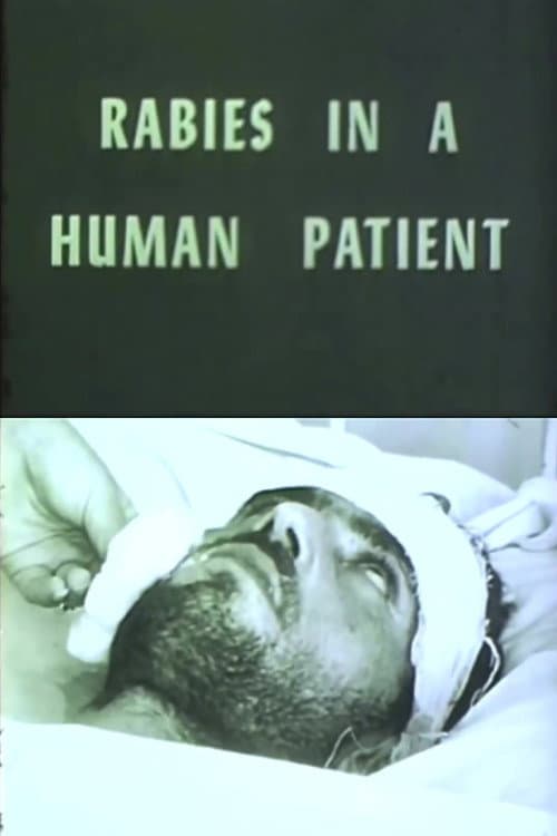 Rabies in a Human Patient